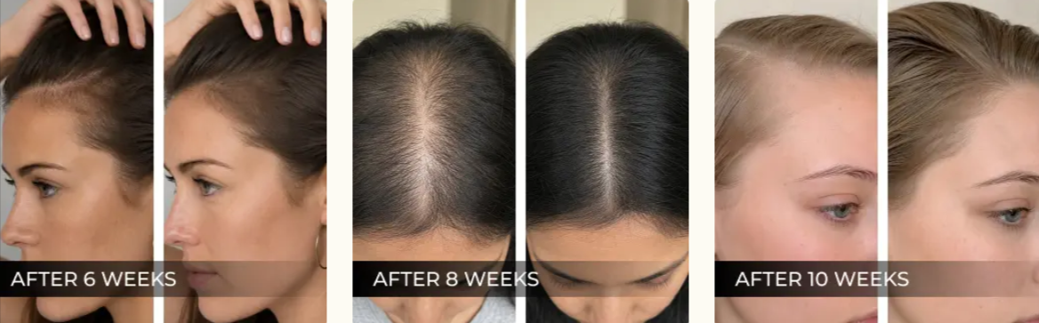 Rovay Red Light Brush Before & After