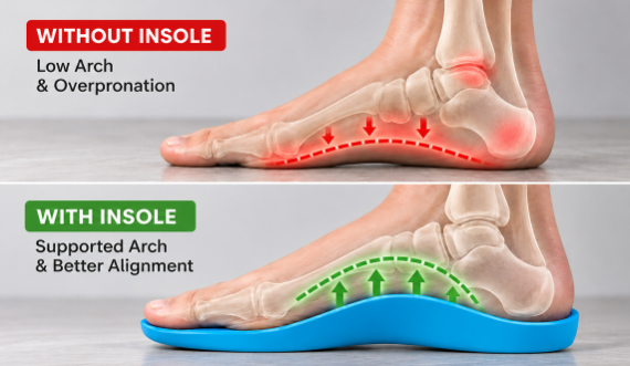 Hewelth Arch Insoles - Work
