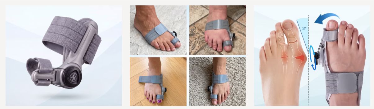Treatmedy Bunion Fix reviews - features