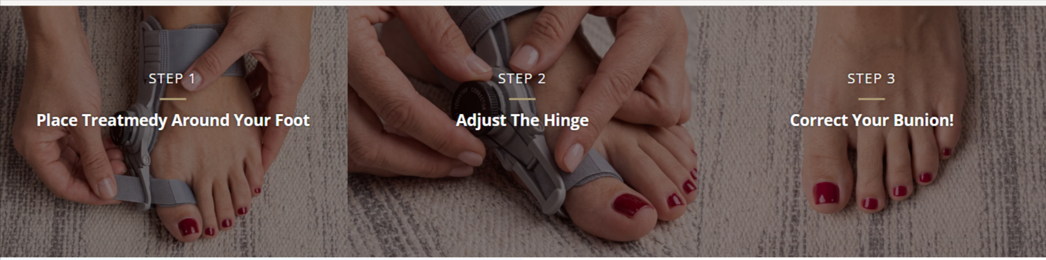 Treatmedy Bunion Fix - steps